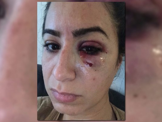 uber-driver-allegedly-punches-woman-in-the-face-in-atlanta-11alive-com
