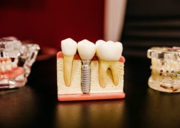 Keep Your Dental Expenses Down with These 6 Tips