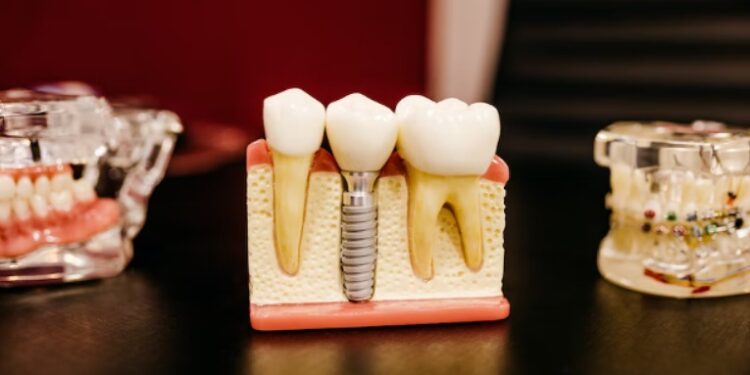 Keep Your Dental Expenses Down with These 6 Tips