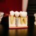Keep Your Dental Expenses Down with These 6 Tips
